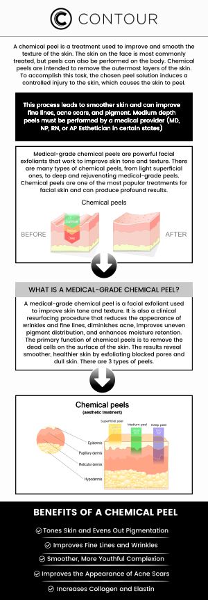 Chemical peels rejuvenate the skin by removing dead cells, and reducing fine lines and blemishes. They promote a smoother, more radiant complexion with customizable treatment options. To learn about the cost, come to us at Contour Medical Spa. Contact us today for more information or request a consultation. We are conveniently located at 18641 Devonshire Street Northridge, CA 91324. Chemical peels rejuvenate the skin by removing dead cells, and reducing fine lines and blemishes. They promote a smoother, more radiant complexion with customizable treatment options. To learn about the cost, come to us at Contour Medical Spa. Contact us today for more information or request a consultation. We are conveniently located at 18641 Devonshire Street Northridge, CA 91324.