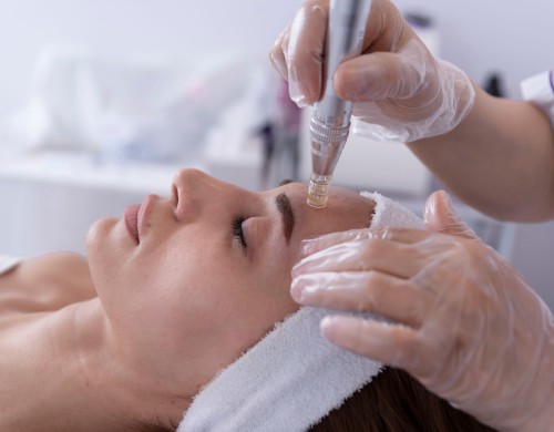 SkinPen Microneedling Treatment Specialist Near Me in Northridge, Los Angeles, CA