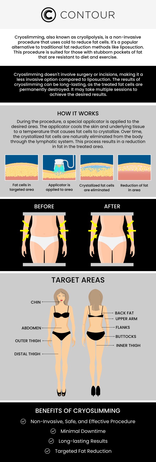 Cryoslimming is a non-invasive treatment that uses controlled cooling to target and freeze stubborn fat cells. At Contour Medical Spa, our team applies this advanced cryotherapy technique to help you achieve a more toned, sculpted appearance by naturally eliminating fat cells. Trust our expert team for safe and effective results tailored to your needs. For more information, contact us or request an appointment online. We are conveniently located at 18641 Devonshire Street Northridge, CA 91324. Cryoslimming is a non-invasive treatment that uses controlled cooling to target and freeze stubborn fat cells. At Contour Medical Spa, our team applies this advanced cryotherapy technique to help you achieve a more toned, sculpted appearance by naturally eliminating fat cells. Trust our expert team for safe and effective results tailored to your needs. For more information, contact us or request an appointment online. We are conveniently located at 18641 Devonshire Street Northridge, CA 91324.