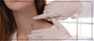 Laser Skin Tag Removal Specialist Near Me in Northridge, Los Angeles, CA Laser Skin Tag Removal Specialist Near Me in Northridge, Los Angeles, CA