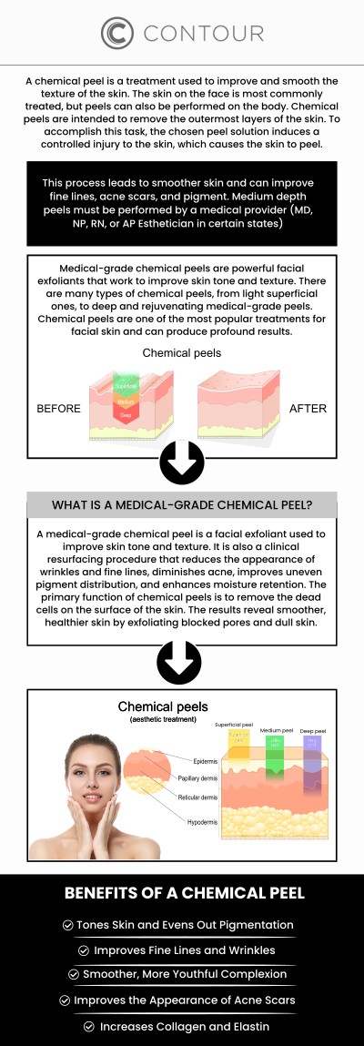 At Contour Medical Spa, Cecilia Scott, RN, BSN, provides professional chemical peel treatments designed to reveal smoother, clearer, and more youthful-looking skin. Before your peel, our team evaluates your skin type and goals to select the most suitable formula. After treatment, mild redness or flaking may occur as your skin renews itself, resulting in a fresh, radiant complexion. We ensure every client receives personalized care and guidance to achieve optimal post-peel recovery and long-lasting glow. For more information, contact us today or schedule an appointment online. We are conveniently located at 18641 Devonshire Street Northridge, CA 91324.