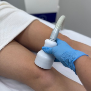 Localized Cryotherapy in Northridge, Los Angeles, CA Localized Cryotherapy in Northridge, Los Angeles, CA