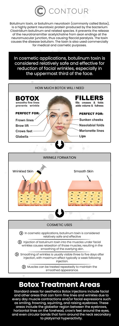 Botox cosmetic injections help smooth out fine lines and wrinkles in the forehead, crow’s feet, and frown lines by temporarily reducing muscle activity in targeted areas. This non-surgical cosmetic treatment can help create a refreshed and more youthful appearance while maintaining natural facial expressions. Botox cosmetic treatments are customized based on each patient’s aesthetic goals, allowing for a personalized approach to wrinkle reduction and facial rejuvenation. Visit Contour Medical Spa today to receive specialized and comprehensive care tailored to your needs. For more information, contact us today to learn more or request an appointment online. Our med spa is conveniently located at 18641 Devonshire Street Northridge, CA 91324. Botox cosmetic injections help smooth out fine lines and wrinkles in the forehead, crow’s feet, and frown lines by temporarily reducing muscle activity in targeted areas. This non-surgical cosmetic treatment can help create a refreshed and more youthful appearance while maintaining natural facial expressions. Botox cosmetic treatments are customized based on each patient’s aesthetic goals, allowing for a personalized approach to wrinkle reduction and facial rejuvenation. Visit Contour Medical Spa today to receive specialized and comprehensive care tailored to your needs. For more information, contact us today to learn more or request an appointment online. Our med spa is conveniently located at 18641 Devonshire Street Northridge, CA 91324.