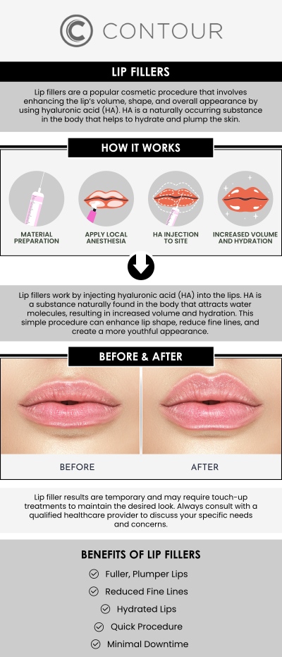 Seeing the results of lip filler treatments can be exciting, and understanding what to expect before and after your session helps set realistic goals. At Contour Medical Spa, clients can anticipate immediate improvements in lip volume and shape, with optimal results developing over the following days as swelling subsides. Our skilled team guides post-treatment care and schedules follow-ups to ensure your lips maintain a smooth, balanced, and natural appearance. For more information, contact us today or request an appointment online. We are conveniently located at 18641 Devonshire Street, Northridge, CA 91324.