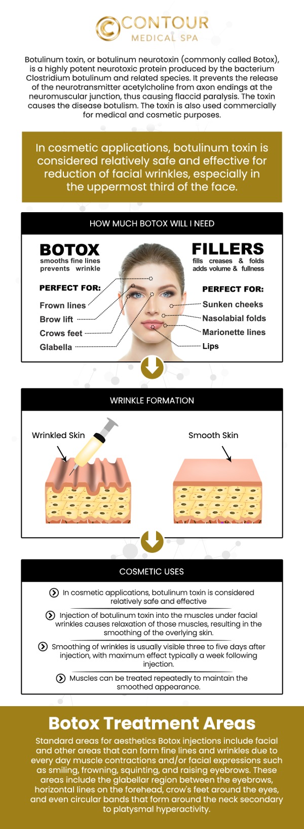 At Contour Medical Spa, our specialists offer Botox injections to reduce the appearance of fine lines and wrinkles, helping you achieve smoother, younger-looking skin. By temporarily relaxing targeted muscles, Botox delivers a non-invasive solution with minimal downtime. The treatment offers lasting results, typically 3-4 months, and is tailored to your individual needs. Our skilled professionals ensure a comfortable experience and natural-looking results. For more information, contact us or request an appointment online. We are conveniently located at 18641 Devonshire Street, Northridge, CA 91324.