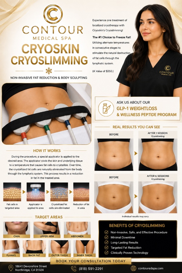 Cryoslimming Specialist in Northridge, Los Angeles, CA