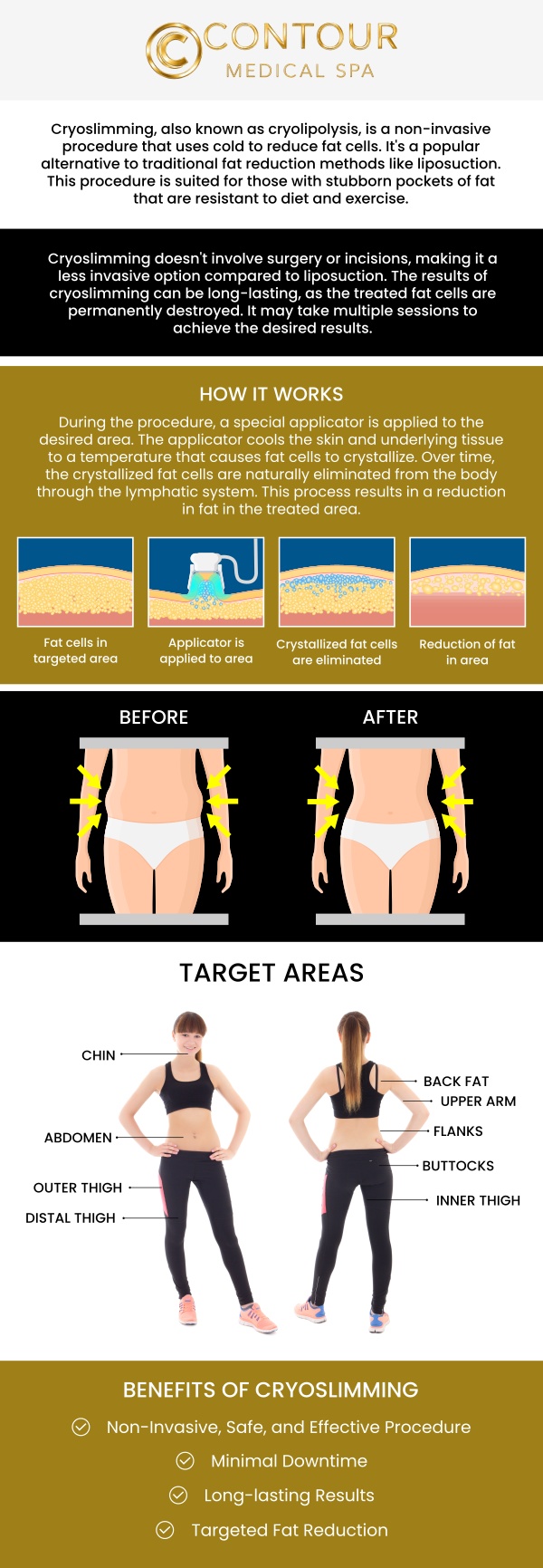 Before your CryoSlimming treatment, it’s important to consult with our expert team to discuss your body contouring goals and treatment areas. During the session, our team will guide you through the process to ensure comfort and clarity. After the procedure, you may experience some temporary redness or slight numbness, but there is no downtime required, allowing you to resume your daily activities immediately. At Contour Medical Spa, Cecilia Scott, RN BSN, along with our skilled team, is dedicated to providing personalized care that helps you achieve your desired body contouring results. For more information, contact us today or request an appointment online. We are conveniently located at 18641 Devonshire Street, Northridge, CA 91324.