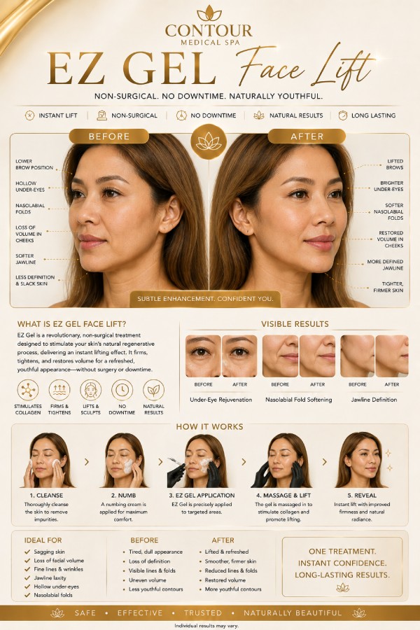 EZ-Gel Liquid Facelift Specialist in Northridge, Los Angeles, CA EZ-Gel Liquid Facelift Specialist in Northridge, Los Angeles, CA