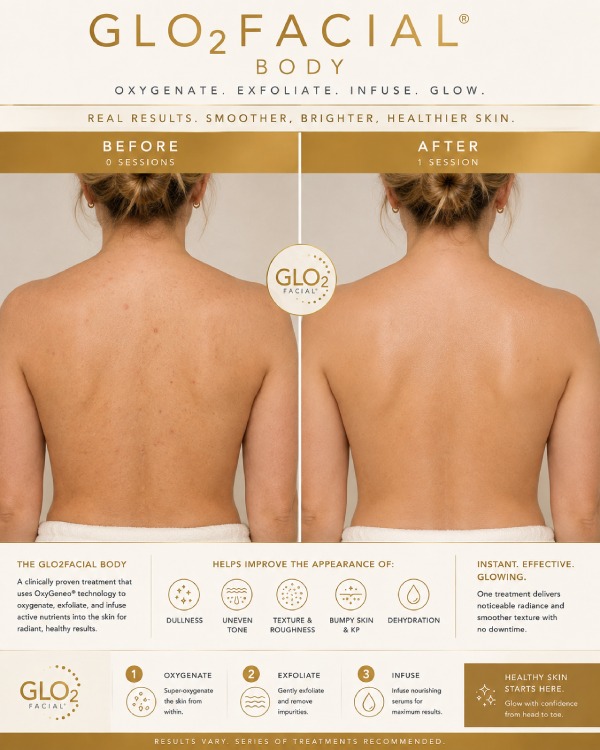 Dermal Body Polishing by Glo2 Before and After in Northridge, Los Angeles, CA Dermal Body Polishing by Glo2 Before and After in Northridge, Los Angeles, CA