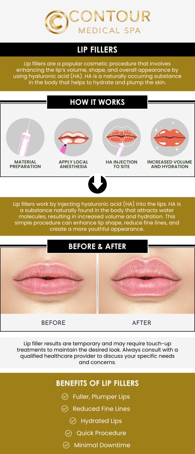 Seeing the results of lip filler treatments can be exciting, and understanding what to expect before and after your session helps set realistic goals. At Contour Medical Spa, clients can anticipate immediate improvements in lip volume and shape, with optimal results developing over the following days as swelling subsides. Our skilled team guides post-treatment care and schedules follow-ups to ensure your lips maintain a smooth, balanced, and natural appearance. For more information, contact us today or request an appointment online. We are conveniently located at 18641 Devonshire Street, Northridge, CA 91324.