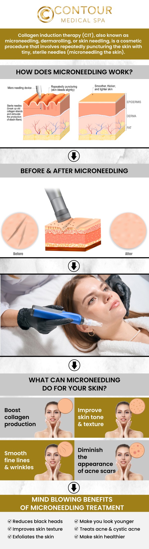 Our microneedling treatment at Contour Medical Spa in Northridge, Los Angeles, CA, is tailored to address a variety of skin concerns, including fine lines, wrinkles, acne scars, and uneven texture. By stimulating natural collagen and elastin production, our skilled team helps clients achieve smoother, firmer, and more radiant skin. Each session is customized to your skin type and goals, ensuring safe, effective, and long-lasting results. For more information, contact us today or request an appointment online. We are conveniently located at 18641 Devonshire Street, Northridge, CA 91324.