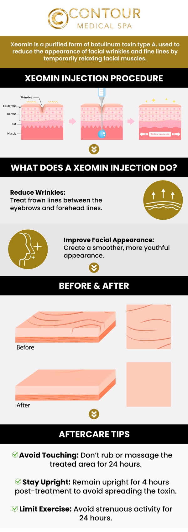 Xeomin is a non-surgical treatment that helps smooth out wrinkles by temporarily relaxing facial muscles. Benefits include reducing frown lines, crow’s feet, and forehead wrinkles, offering a more youthful, refreshed appearance. Ideal for individuals looking to enhance their facial aesthetics without downtime. Our specialists offer Xeomin treatments at Contour Medical Spa to help you achieve a smooth, rejuvenated look. For more information, contact us or schedule an online appointment. We are conveniently located at 18641 Devonshire Street Northridge, CA 91324. Xeomin is a non-surgical treatment that helps smooth out wrinkles by temporarily relaxing facial muscles. Benefits include reducing frown lines, crow’s feet, and forehead wrinkles, offering a more youthful, refreshed appearance. Ideal for individuals looking to enhance their facial aesthetics without downtime. Our specialists offer Xeomin treatments at Contour Medical Spa to help you achieve a smooth, rejuvenated look. For more information, contact us or schedule an online appointment. We are conveniently located at 18641 Devonshire Street Northridge, CA 91324.