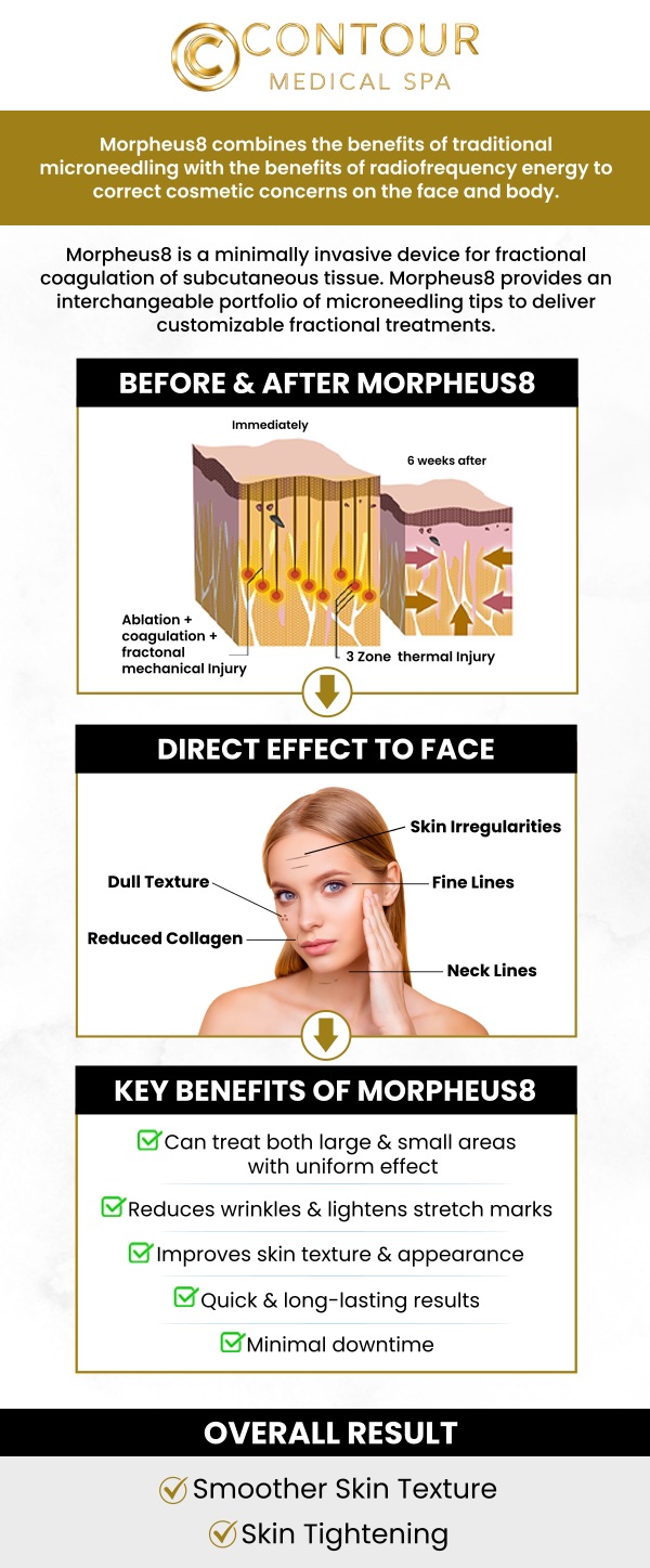 Acne scars and uneven skin texture can affect the smoothness and appearance of the skin over time. Morpheus8 combines microneedling technology with radiofrequency energy to support skin remodeling and encourage a smoother-looking complexion. Our professional team uses advanced aesthetic technology like Morpheus8 to help address concerns related to skin tone, texture, and firmness through a personalized treatment approach. At Contour Medical Spa, we provide customized skin rejuvenation plans designed to help clients achieve refreshed, healthier-looking skin while addressing individual acne scar and texture concerns. For more information, contact us today or request an appointment online. We are conveniently located at 18641 Devonshire Street, Northridge, CA 91324. Acne scars and uneven skin texture can affect the smoothness and appearance of the skin over time. Morpheus8 combines microneedling technology with radiofrequency energy to support skin remodeling and encourage a smoother-looking complexion. Our professional team uses advanced aesthetic technology like Morpheus8 to help address concerns related to skin tone, texture, and firmness through a personalized treatment approach. At Contour Medical Spa, we provide customized skin rejuvenation plans designed to help clients achieve refreshed, healthier-looking skin while addressing individual acne scar and texture concerns. For more information, contact us today or request an appointment online. We are conveniently located at 18641 Devonshire Street, Northridge, CA 91324.