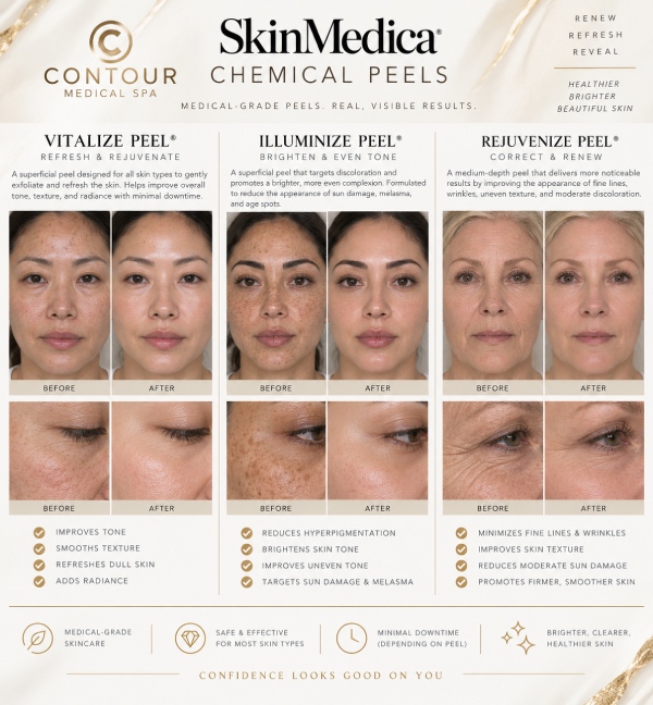 SkinMedica Chemical Peels Specialist in Northridge, Los Angeles, CA