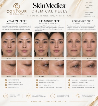 SkinMedica Chemical Peels are professional-grade skin rejuvenation treatments designed to exfoliate the skin, remove dull surface cells, and support a brighter, smoother, more refreshed complexion. The Vitalize Peel helps improve dull skin, uneven tone, and texture with minimal downtime, making it ideal for first-time peel patients and maintenance care. The Illuminize Peel targets discoloration, sun damage, melasma, and uneven skin tone to promote a more radiant appearance. The Rejuvenize Peel offers deeper exfoliation to improve the appearance of fine lines, wrinkles, rough texture, acne scarring, and moderate sun damage for overall skin renewal. For more information contact us today or request a consultation. We are conveniently located at 18641 Devonshire Street Northridge, CA 91324.